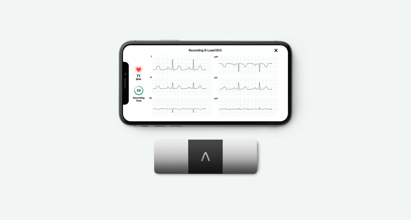 6-lead ECG being taken with KardiaMobile 6L