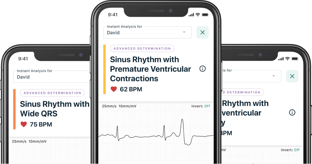 image of mobile devices showing the new Advanced Determinations feature as part of KardiaCare